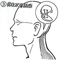 ③貝柱状硬結感