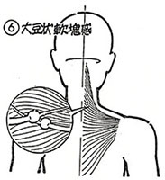 ⑥大豆状軟塊感