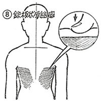 ⑧鉄板状厚結感