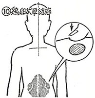 ⑩鶏卵状厚結感