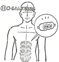 ⑪ロールハム状硬結感