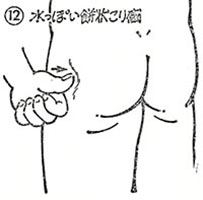 ⑫水っぽい餅状こり感