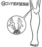 ⑭コンブ茎状緊張感